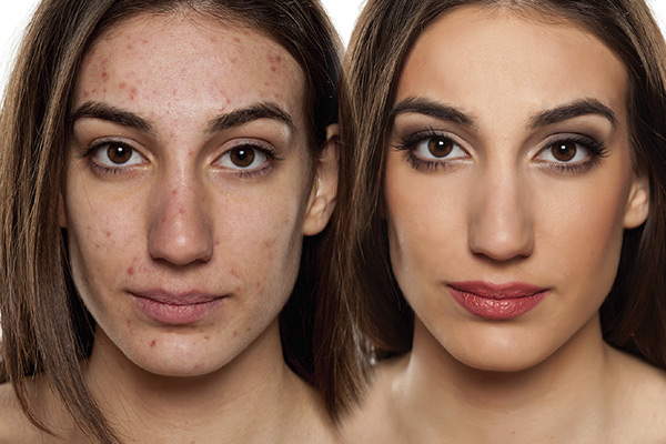 SKIN TREATMENTS MENU SKIN TREATMENTS MENU